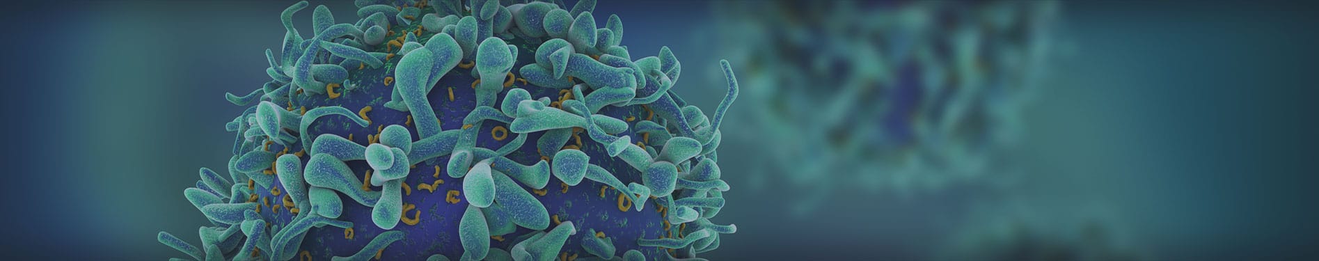 רשלנות רפואית באבחון סרטן